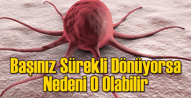 Başınız Dönüyorsa Sebebi Tümör Olabilir