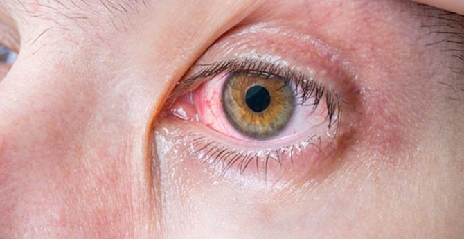 Başınızın Ağrısı Bu Yüzden Olabilir!