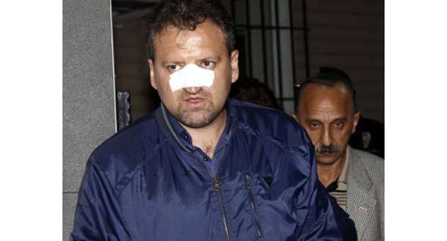 Başkan Yardımcısı öğretmene kafa attı!