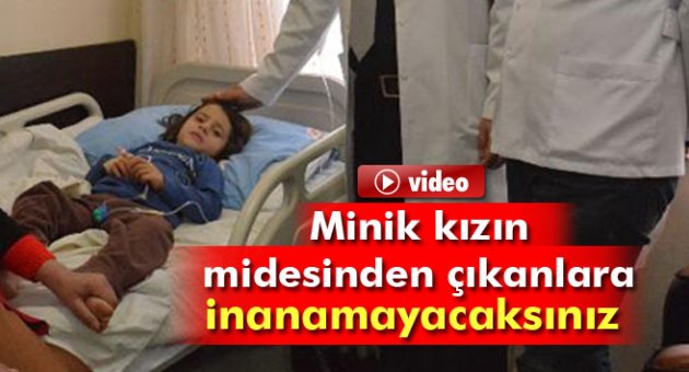 Beş yaşındaki çocuğun karnından 52 solucan çıkarıldı