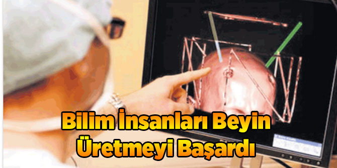 Bilim İnsanları Beyin Üretmeyi Başardı