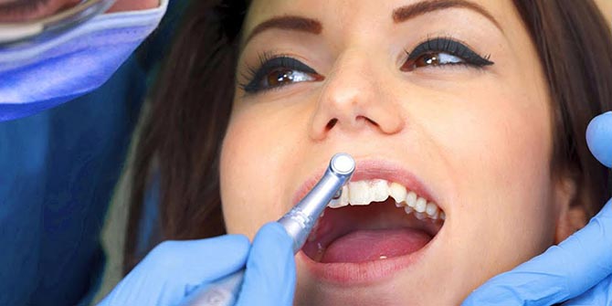 Bir Saatte Dişerinizi Düzelttirebilirsiniz