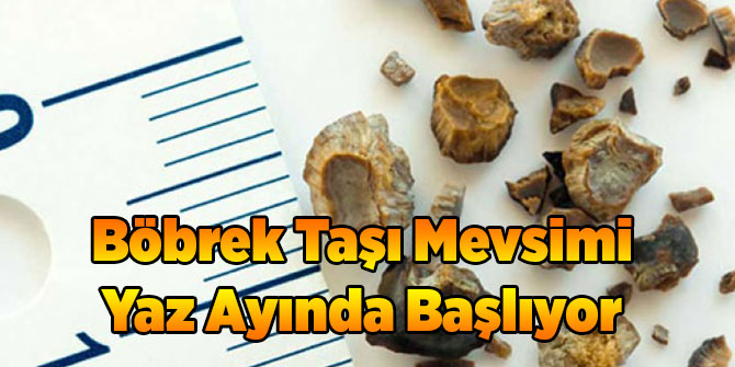 Böbrek Taşı Mevsimi Yaz Ayında Başlıyor