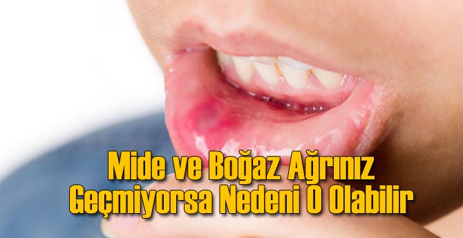 Boğaz ve Mide Ağrınız Geçmiyorsa Sebebi O Olabilir