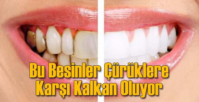 Bu Besinler Dişlere Kalkan Oluyor