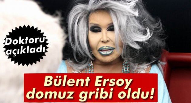 Bülent Ersoy domuz gribi oldu! Doktoru açıkladı