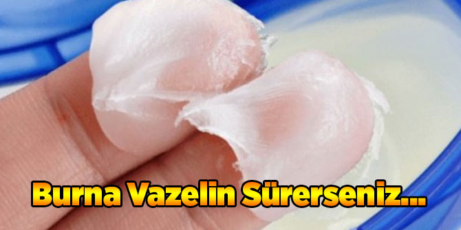 Burnunuzun Kenarlarına Vazelin Sürerseniz...