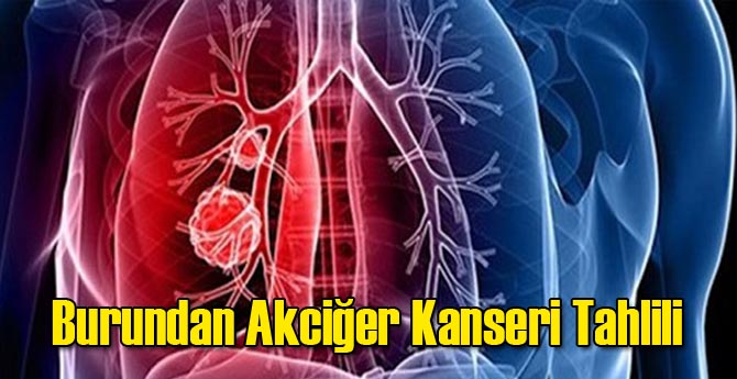 Burundan Akciğer Kanseri Tahlili!