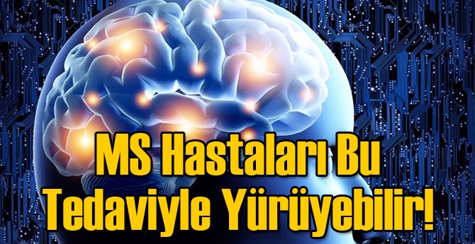 Bu Tedaviyle MS Hastaları Yürüyebiliyor!