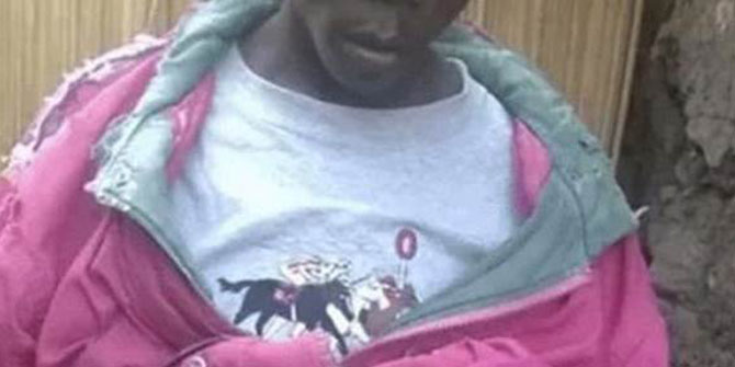 Cinsel Organının Sürekli Büyümesi Hayatını Mahvetti