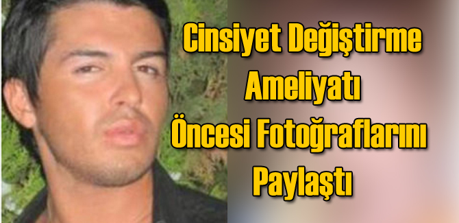 Cinsiyet Değiştirme Ameliyatı Öncesi Sonrası Paylaştı