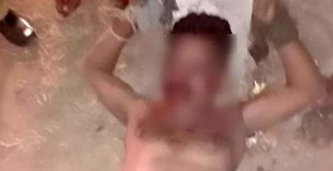 Çırılçıplak Soyup Elektrik Verdiler