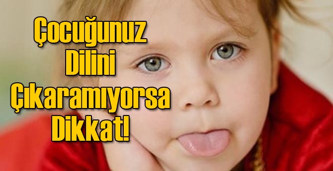 Çocuğunuz Dilini Çıkaramıyorsa Dikkat!