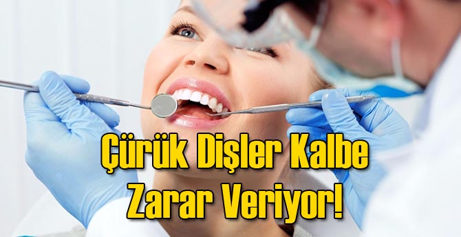 Çürük Dişler Kalbe Zarar Veriyor!