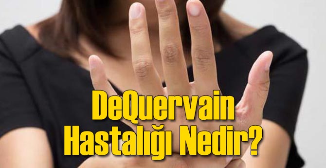 DeQuervain Hastalığı Nedir?
