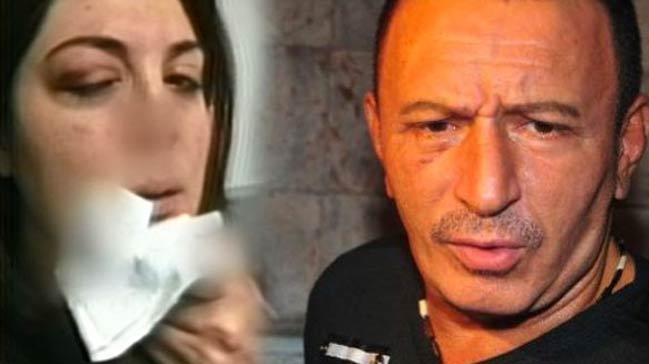 Derya Topaloğlu'nu hastanelik etti