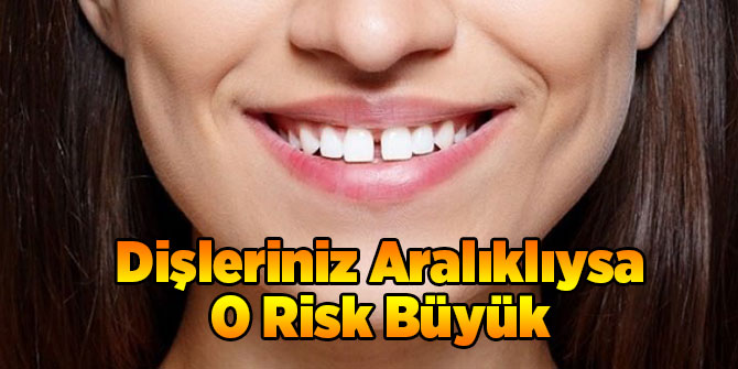 Dişleriniz Aralıklıysa O Risk Büyük