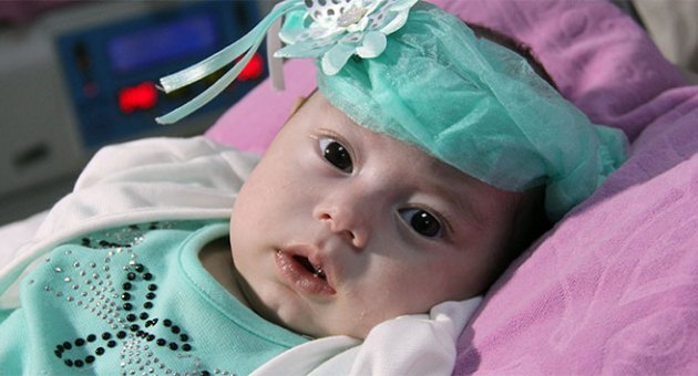 Dört aylık bebek 'doku yapıştırıcısıyla' hayata tutundu