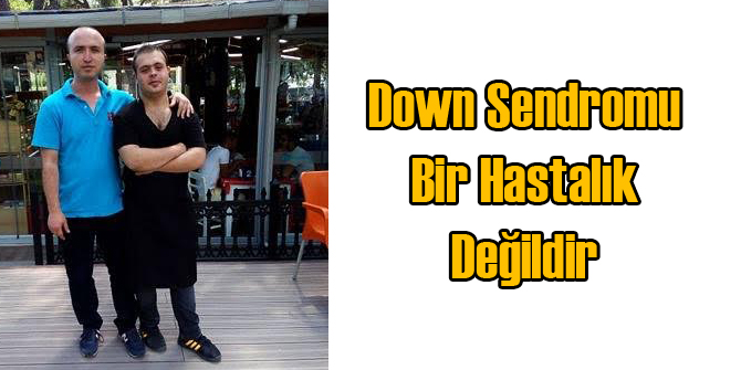 Down Sendromu Bir Hastalık Değil!