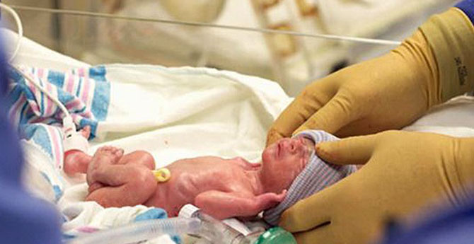 Dünyada Her Yıl 150 Bin Prematüre Doğuyor