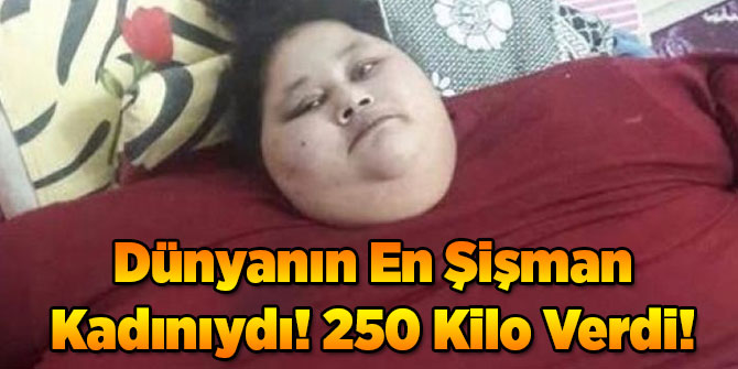 Dünyanın En Şişman Kadınıydı! 250 Kilo Verdi!