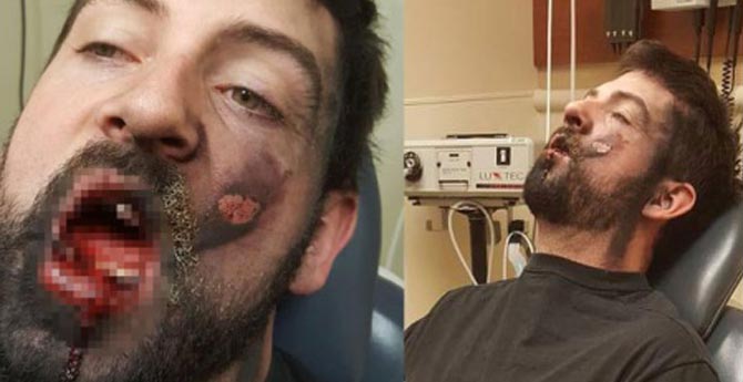 Elektronik Sigara Faciası!