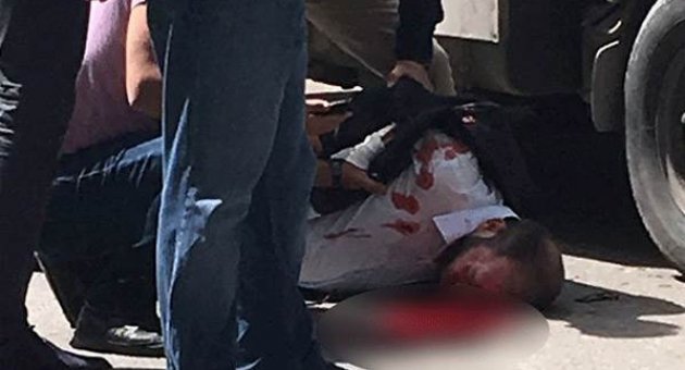 Ensesinden vurulan gazeteci hayatını kaybetti!