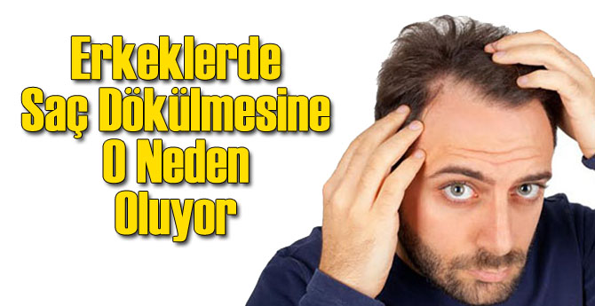 Erkeklerde Saç Dökülmesine O Neden Oluyor