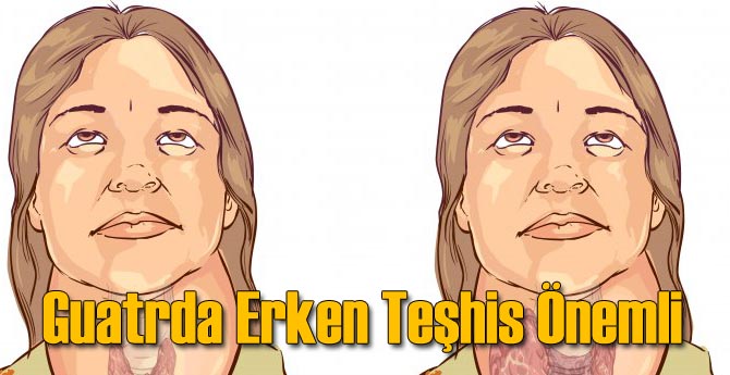 Guatrda Erken Teşhis Önemli