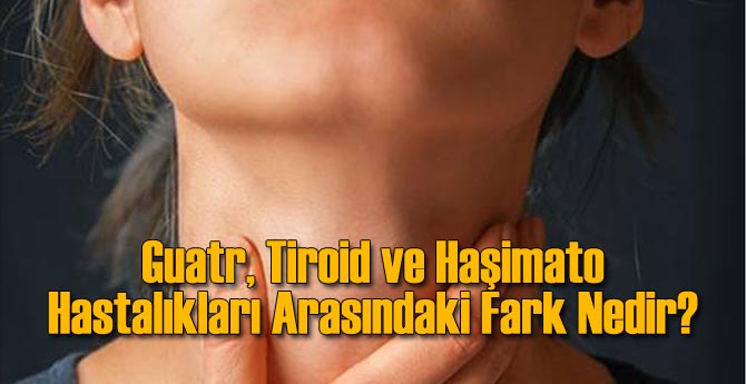 Guatr, Tiroid ve Haşimato Hastalıkları Arasındaki Fark Nedir?