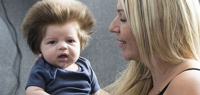 Gür Saçlı Bebek Ünlü Olduktan Sonra...