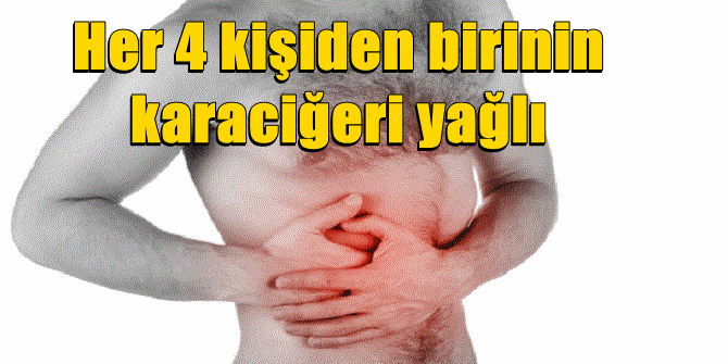 Her 4 kişiden birinin karaciğeri yağlı