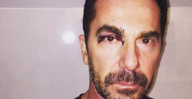 Ilker Inanoglu Nun Hali Sok Etti Magazin Ege Politik Ilker Inanoglu Nun Hali Sok Etti Magazin Ege Politik