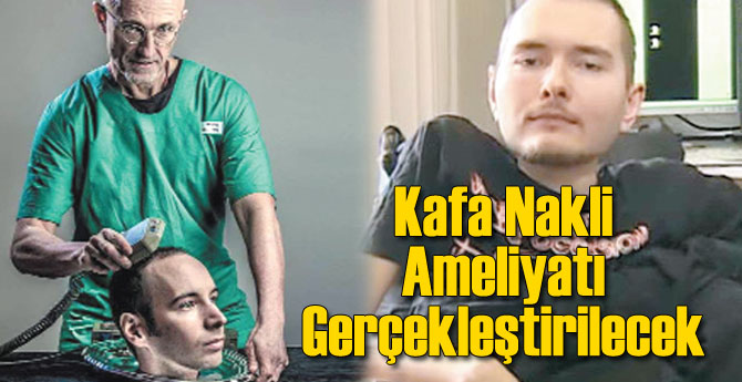 İlk Kafa Nakli Ameliyatı Gerçekleştirilecek