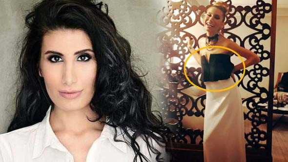 İrem Derici bir deri, bir kemik kaldı