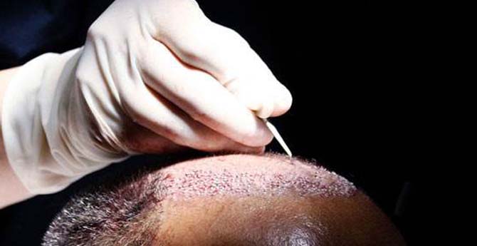 IŞİD'li Terörist Öyle Bir Yalan Söyledi ki...