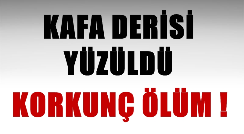 Kafa derisi yüzüldü! Korkunç ölüm