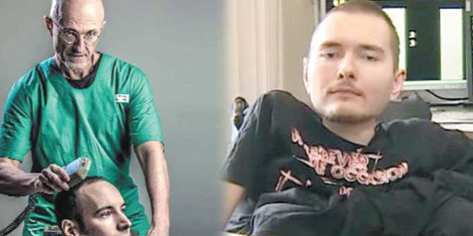 Kafa Nakli İçin Tarih Belirlendi