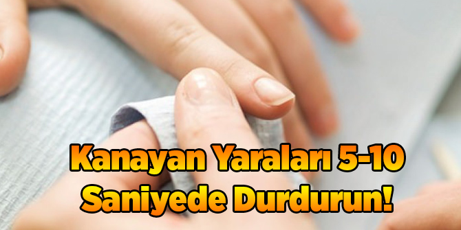 Kanayan Yaraları 10 Saniyede Durdurabilirsiniz!