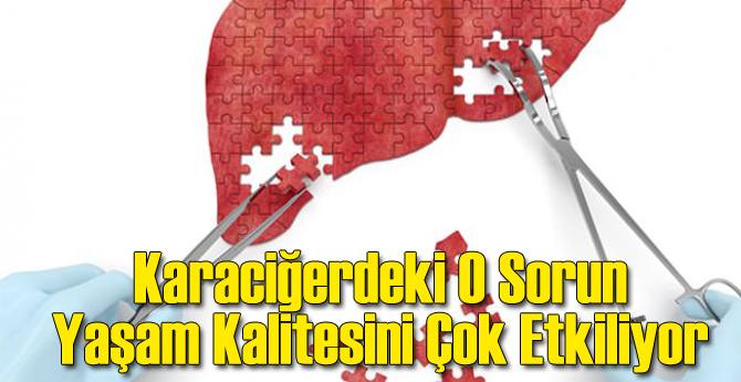 Karaciğerde O Sorun Yaşam Kalitesini Düşürüyor