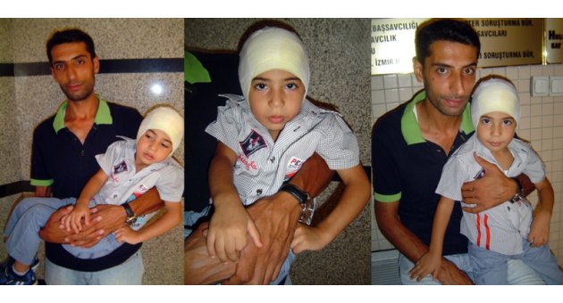 Kerem'in kulağını koparan köpeğin sahibine hapis