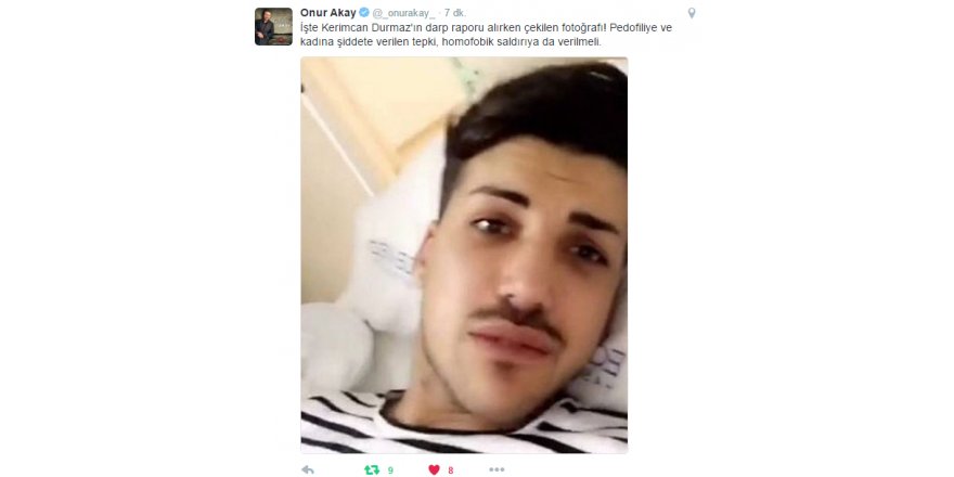 Kerimcan Durmaz&#039;ın yüzünün hali