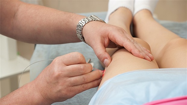 Kısa sürede lazerle varis tedavisi