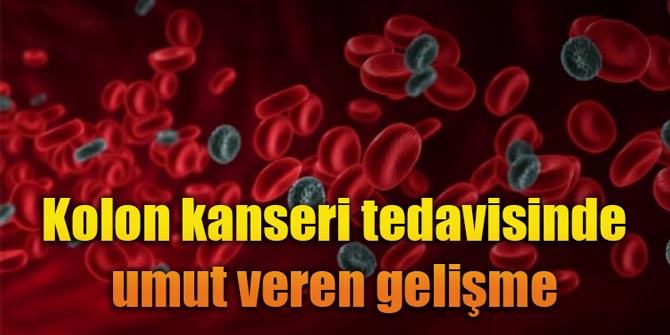 Kolon kanseri tedavisinde umut veren gelişme
