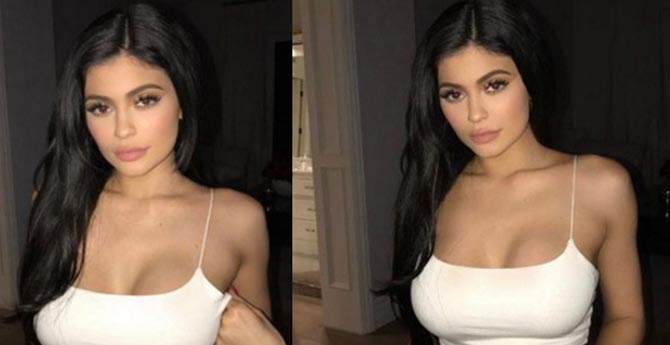Kylie Jenner'ın Göğüsleri Neden Sürekli Büyüyor!