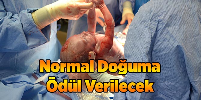 Normal Doğuma Ödül Verilecek