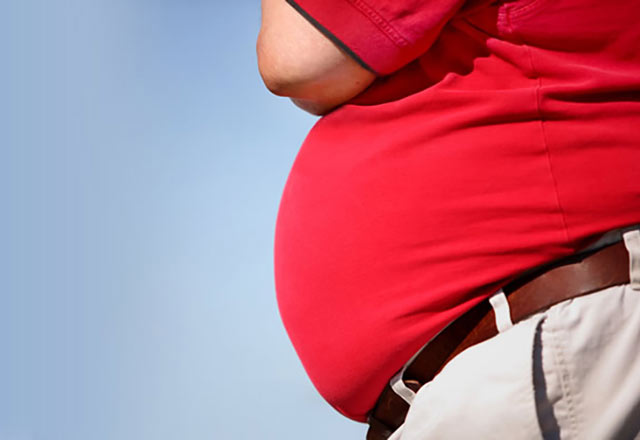 Obezite ameliyatı ilk çare mi?