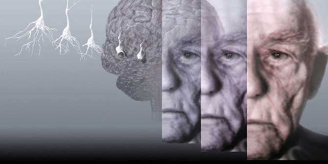 O Hastalığı Geciktirmenin İmkanı Var mı?