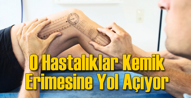 O Hastalıklar Kemikleri Eritiyor!