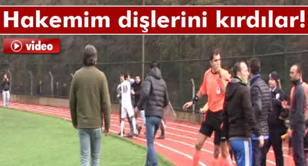 Olaylı maçta hakemin dişlerini kırdılar
